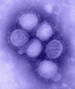 This image of the newly identified H1N1 influenza virus ("Swine Flu") was taken in the Centers For Disease Control & Prevention (CDC) Influenza Laboratory.